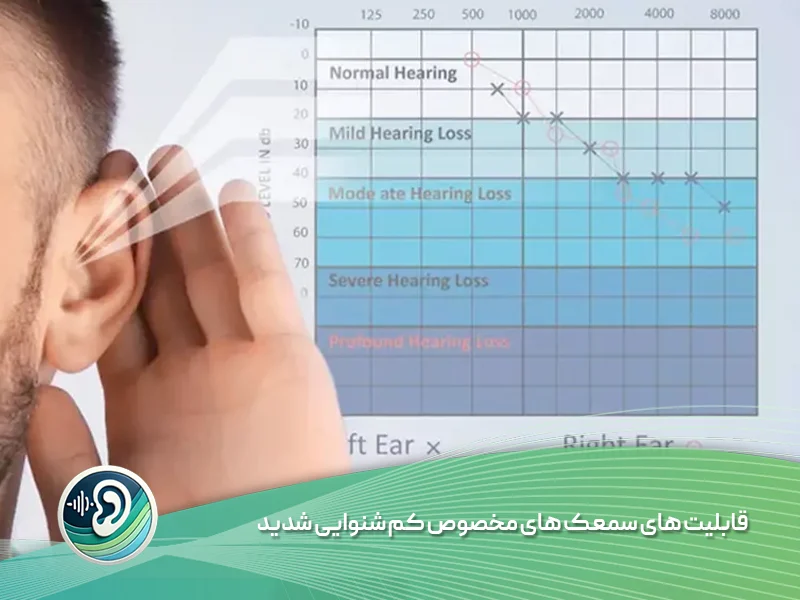 سمعک مخصوص کم شنوایی شدید