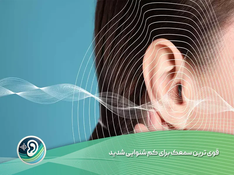 سمعک برای کم شنوایی شدید