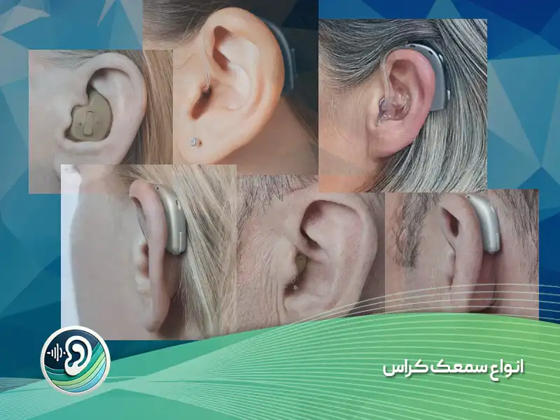 انواع سمعک کراس