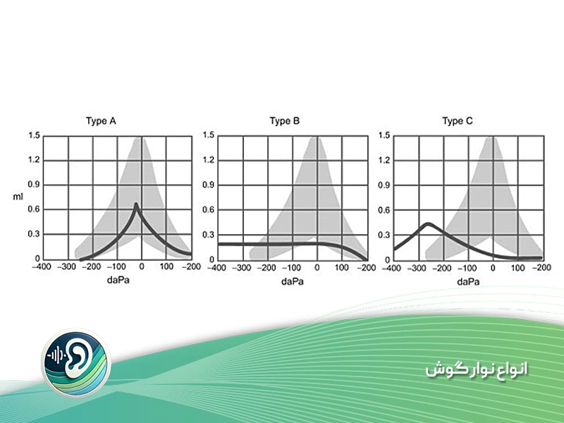 انواع نوار گوش