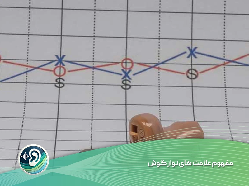 تفسیر نوار گوش