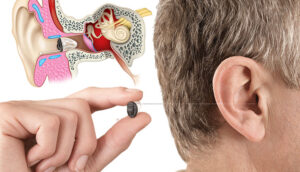 تجویز سمعک شمس