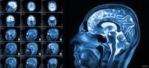 رادیولوژیست چه نقشی در تشخیص بیماریها دارد؟ 2 رادیولوژی گوش