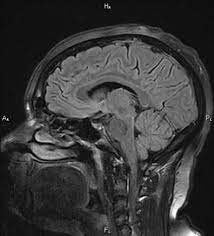 رادیولوژی گوش