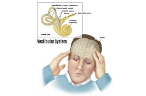 اختلال وستیبولار| شبکه متخصصین سمعک شمس